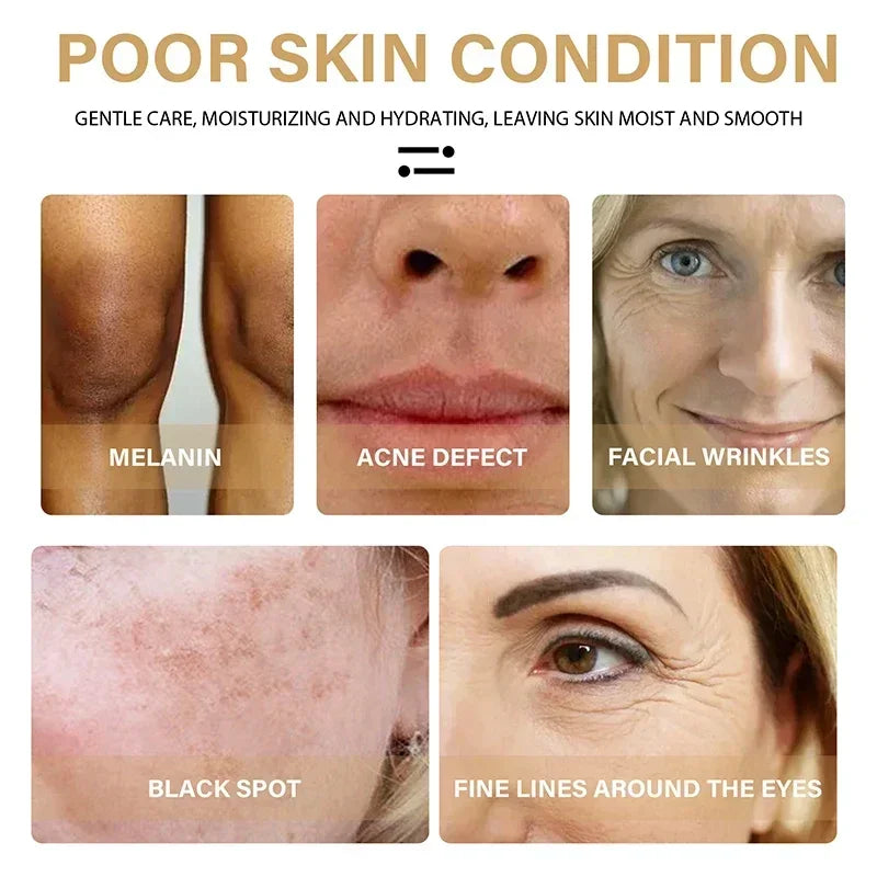 Turmeric Oil Skin To Lightening Acne