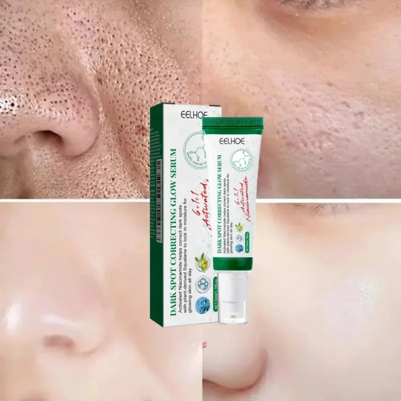 Pore Shrinking Cream Acne Pit Repair Product for Men/Women