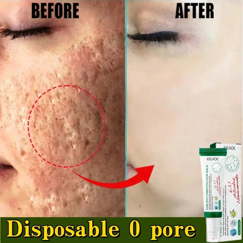 Pore Shrinking Cream Acne Pit Repair Product for Men/Women